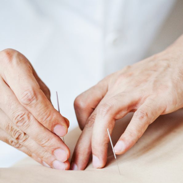 Sherwood Park Physiotherapy clinic - acupuncture